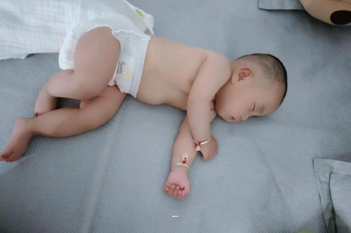 樟树宝宝突然很多眼屎